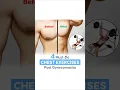 Download Lagu 4 Must Do Chest Exercises After Gynecomastia Surgery #shortsvideo