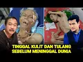 Download Lagu Sangat Miris, Tubuh 7 Artis Ini HanyaTinggal Kulit Dan Tulang Sebelum Meninggal Dunia