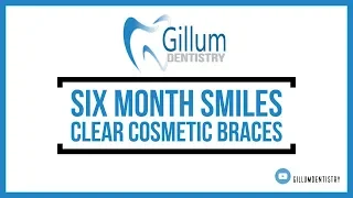 Six Month Smiles Short-Term Clear Braces Gillum Dentistry Greenwood IN