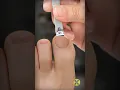 Channel