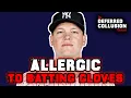 Yankees Alex Verdugo says he s allergic to batting gloves because he has too many tattoos