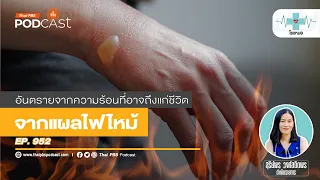 ทำไมต้องติดตามอาการแผลไฟไหม้หลังหายดีแล้ว