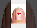Download Lagu If you see this line on your nail you are in danger 😱