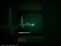 Download Lagu Nih video ilustrasi detak jantung rumah sakit