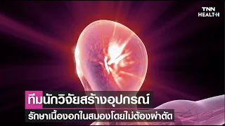 การรักษาเนื้องอกในสมองด้วยอุปกรณ์ไร้สายที่พัฒนาโดยทีมแพทย์จาก Stanford ทำงานอย่างไร