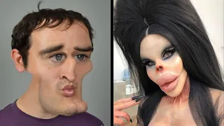 10 unusual people who took plastic surgery too far 