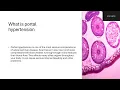 NURISNG DIAGNOSIS AND CARE PLAN FOR CIRROHSIS OF LIVER-NANDA NURSING DIAGNOSIS