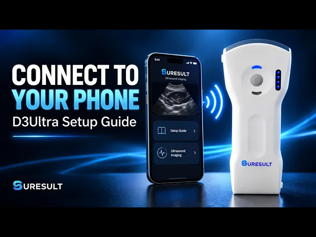 Video: hoe u een Suresult handheld echoprobe met een telefoon verbindt
