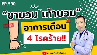 อาการขาบวมทั้งสองข้างอาจเป็นสัญญาณของโรคอะไรบ้าง?