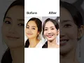 Download Lagu K-celebs ruined face with plastic surgery 📸✨#goviral #kpop #shorts #parkminyoung #youtube #NINNIEWON