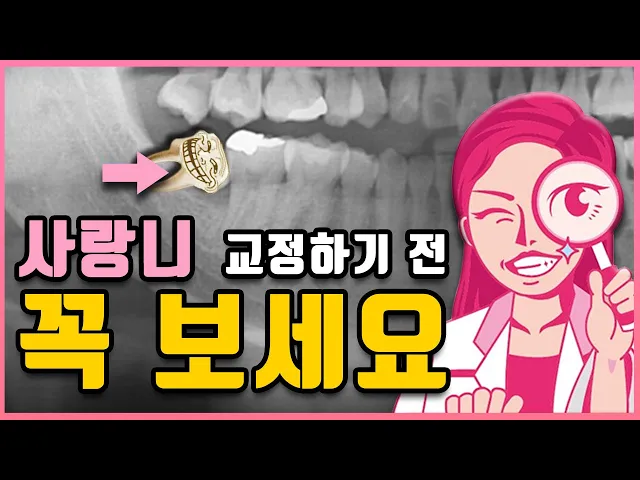 치아교정 사랑니 발치하기 전 주의사항, 사랑니 발치 안 하는 방법 꼭 확인하세요
