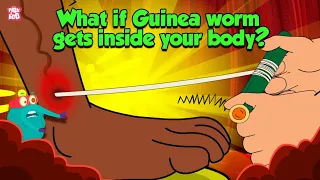 deadliest parasite what if guinea worm gets inside your body dracunculiasis dr binocs show