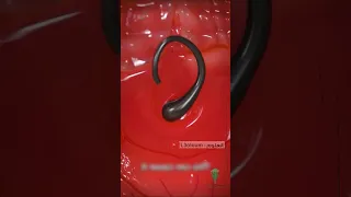 شاهد مخاطر نزع الشعر Shorts 