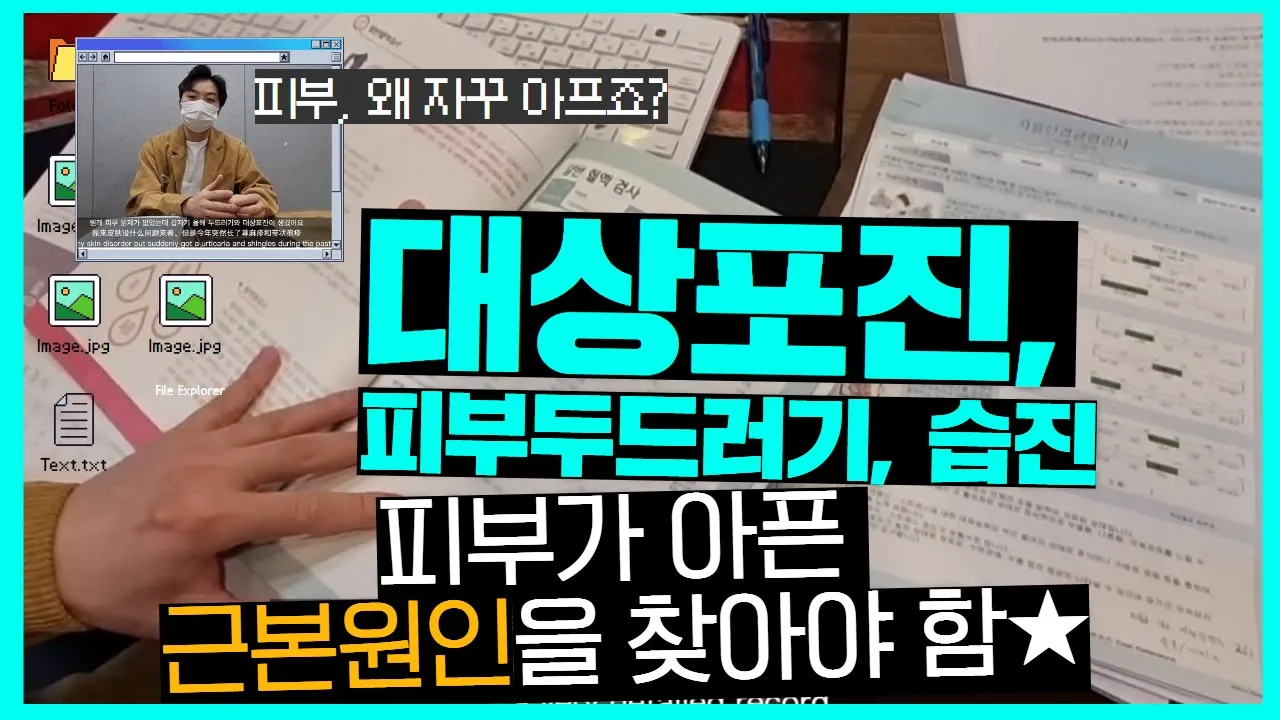 컨디션 떨어지면 올라오는 피부수포, 두드러기, 포진 | 대상포진, 두드러기 기능의학피부과 전문의
