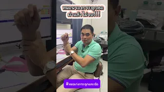  ทำไมการผ่าตัดเชื่อมกระดูกคอถึงอาจทำให้เกิดปัญหาข้อต่อเสื่อมในระยะยาว  