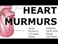 Download Lagu Heart Murmurs | Locations, Maneuvers, Buzzwords