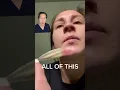 What Does a Hydrocolloid Patch Do For Acne
