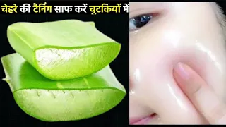 रात में Aloevera ऐसे लगालो एकदम से चेहरा इतना गोरा करदेगा कि आप देखते रह जाओगे Gora Hone ka tarika