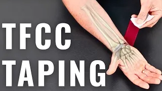 TFCC ECU Wrist Pain Taping RockTape Kinesiology Tape Technique