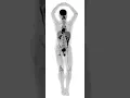 Video di EXPLORER Total Body PET scan