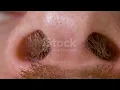 Hairy nostrils and nose of caucasian man close up in macro