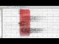 EEG in Juvenile Myoclonic Epilepsy