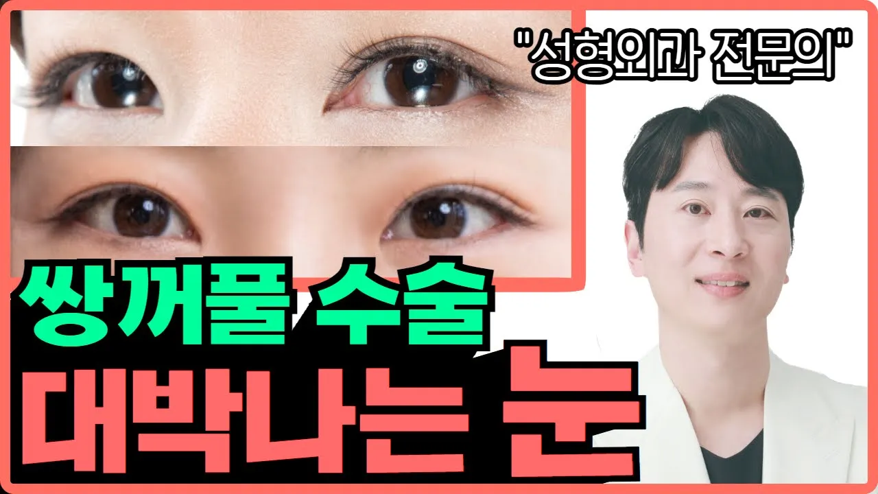쌍꺼풀 수술로 대박나는 눈은?