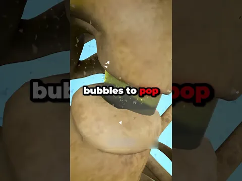 NEVER CRACK YOUR NECK π¨