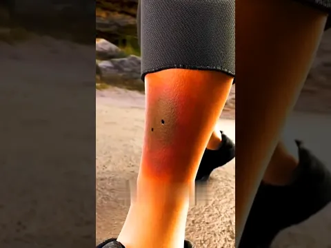 What would happen if you accidentally stepped on a snake? 😱