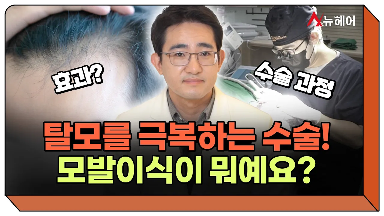 탈모를 극복하는 수술 모발이식! 그게 뭔가요?ㅣ뉴헤어