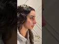 Download Lagu Scarless Facelift and Revision Rhinoplasty by Dr.TAS