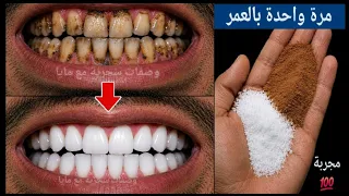 اقسم بالله لن تحتاج للذهاب لطبيب الأسنان ‼️واسقاط الجير سيسقط بلا رجعة‼️ تبييض الاسنان فى ثوانى