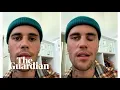 Download Lagu Justin Bieber cancels shows after half of face left paralysed by virus