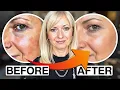 Retinol Peeling and Stinging Here s What You re Doing Wrong
