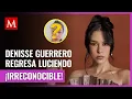 Denisse Guerrero lead singer of Belanova sparks concern over her facial appearance