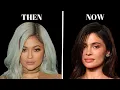 Kylie Jenner s Transformation Before and After Plastic Surgery