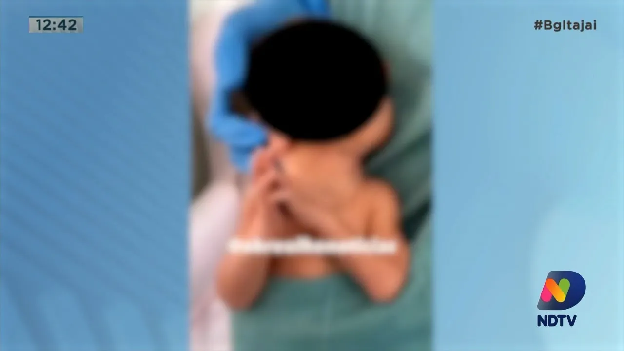 Bebê colocado no bolso de jaleco no hospital Marieta contraiu bactéria