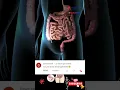 Download Lagu Appendicitis [] Appendix Location [] Appendicitis symptoms