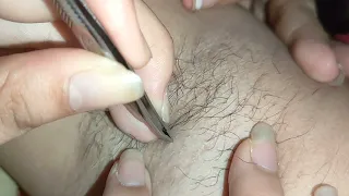 hairy armpit plucking again mommy ivy