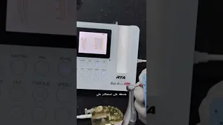 هل تبحث عن جهاز روتاري قوي وفعال هذا الفيديو يقدم لك مراجعة تشرح كل مميزات جهاز EndoRadar Pro 