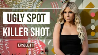 Ugly Spot Ki!!er Shot // Las Vegas Streets
