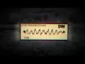 Download Lagu LIHAT KEBUNKU || PHONK