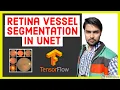Retina Blood Vessel Segmentation using UNET in TensorFlow 2 0 Keras Image Segmentation