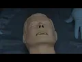 Spinal Injury Jaw Thrust