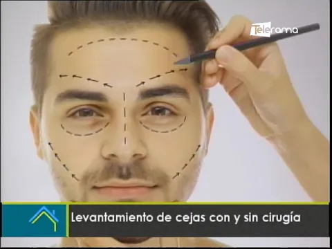 Estética al Día: Levantamiento de cejas con y sin cirugía