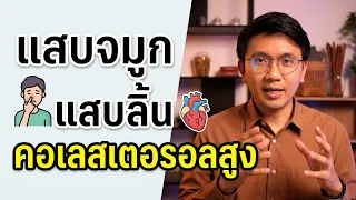 แสบจมูก แสบลิ้น | คอเลสเตอรอลสูง | เจ็บหนังศีรษะ - หมอนัท ตอบคำถาม