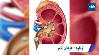 د پښتورګو تيږې په دغه څو ساده او اسانه کورنيو لارو سره لرې کړئ 
