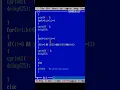 C PROGRAMMING - How to print B alphabet in Pattern-Pattern Printing Programs