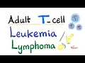Download Lagu Adult T- cell Leukemia / Lymphoma - Human T-cell Leukemia Virus (HTLV-1) - Oncology