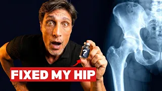 I Thought I Needed Hip Surgery, But This Peptide Fixed It